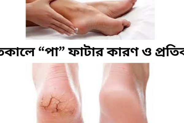 শীতকালে পা ফাটার কারণ ও প্রতিকার
